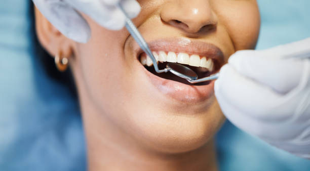 Best Emergency Dental Extractions in Norristown, PA